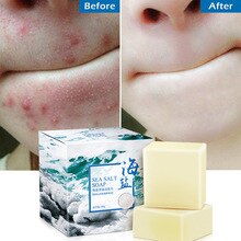 100g Sea Salt Soap Cleaner Removal Pimple Pores Acne Treatment Natural Goat Milk Moisturizing Face Body Care Wash Whitening Soap