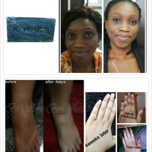 Charcoal Soap Gluta Whitening Reduce Dark Spots Soft Skin Cleaning Dark Knuckles Net 100 G Free Shipping